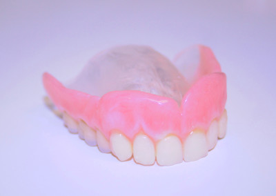 Prothèse dentaire complète (prothèse dentaire complète amovible) Sainte-Rose | Hogan et Messier Denturologistes - Rosemère