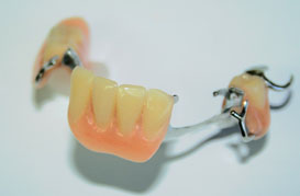 Prothèse dentaire partielle amovible | Hogan et Messier denturologistes